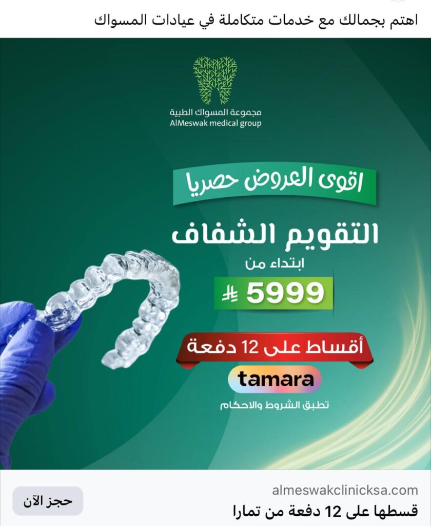 زراعة شعر